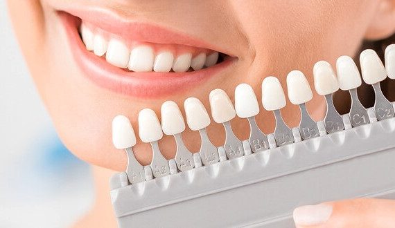 cosmetic dentist in madeley