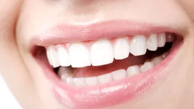 Teeth Whitening Aberdeen