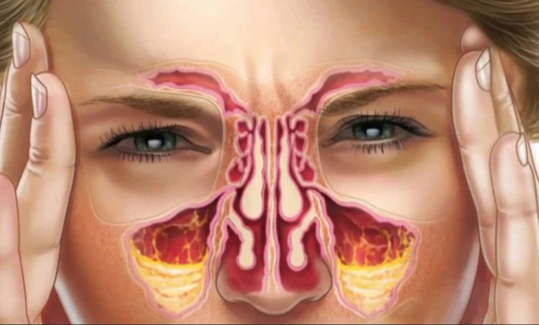 sinus treatment aurora